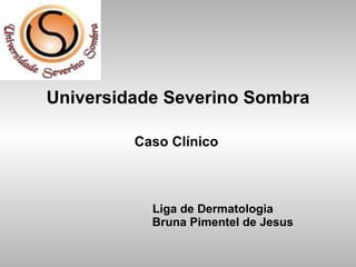 Universidade Severino Sombra Caso Clínico     Liga de Dermatologia   Bruna Pimentel de Jesus 