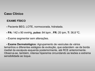 Caso Clínico   EXAME FÍSICO   -  Paciente BEG, LOTE, normocorada, hidratada.   - PA:  142 x 90 mmHg,  pulso:  84 bpm ,  FR:  20 ipm,  T:  36,8 ºC.   -  Exame segmentar sem alterações.   - Exame Dermatológico:  Agrupamento de vesículas de vários tamanhos e diferentes estágios de evolução, que extendem -se da borda medial da escápula esquerda posteriormente, até RCE anteriormente. Observa-se, também, intensa hiperemia circundando as lesões e extrema sensibilidade ao toque. 