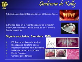 UGMA
4. Extrusión de los dientes anteriores y pérdida de hueso
5. Pérdida ósea en el reborde posterior en el maxilar
inferior, situado debajo de las bases de una prótesis
Parcial removible.
Signos asociados. Saunders. 1979
 Pérdida de la dimensión vertical
 Discrepancia del plano oclusal
 Reposición anterior de la mandibula
 Mala adaptación de la prótesis
 Epulis Fisurado
 Cambios periodontales
Sindrome de Kelly
 