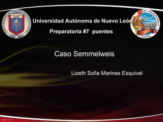 Universidad Autónoma de Nuevo León
Preparatoria #7 puentes

Caso Semmelweis
Lizeth Sofia Marines Esquivel

 