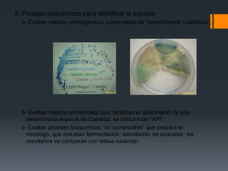 5- Pruebas bioquímicas para identificar la especie:
  a- Existen medios cromogénicos comerciales de “aproximación cualitativa”.




  b- Existen medios comerciales que certifican el aislamiento de una
    determinada especie de Candida, se denominan “API”.
  c- Existen pruebas bioquímicas “no comerciales” que prepara el
    micólogo, que estudian fermentación, asimilación de azúcares; los
    resultados se comparan con tablas estándar.
 