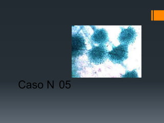 Caso N 05
 
