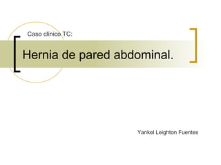 Hernia de pared abdominal.
Caso clínico TC:
Yankel Leighton Fuentes
 