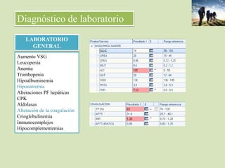 Diagnóstico de laboratorio
LABORATORIO
GENERAL
Aumento VSG
Leucopenia
Anemia
Trombopenia
Hipoalbuminemia
Hiponatremia
Alteraciones PF hepáticas
CPK
Aldolasas
Alteración de la coagulación
Crioglobulinemia
Inmunocomplejos
Hipocomplementemias
 