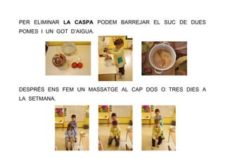 PER ELIMINAR LA CASPA PODEM BARREJAR EL SUC DE DUES
POMES I UN GOT D’AIGUA.
DESPRÉS ENS FEM UN MASSATGE AL CAP DOS O TRES DIES A
LA SETMANA.