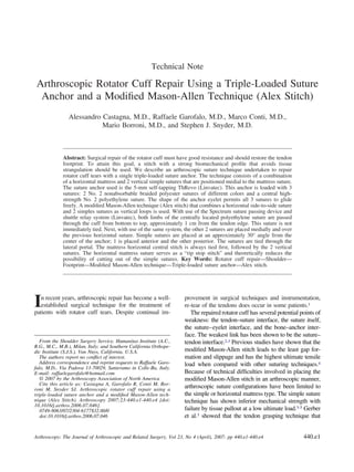 Technical Note
Arthroscopic Rotator Cuff Repair Using a Triple-Loaded Suture
Anchor and a Modiﬁed Mason-Allen Technique (Alex Stitch)
Alessandro Castagna, M.D., Raffaele Garofalo, M.D., Marco Conti, M.D.,
Mario Borroni, M.D., and Stephen J. Snyder, M.D.
Abstract: Surgical repair of the rotator cuff must have good resistance and should restore the tendon
footprint. To attain this goal, a stitch with a strong biomechanical proﬁle that avoids tissue
strangulation should be used. We describe an arthroscopic suture technique undertaken to repair
rotator cuff tears with a single triple-loaded suture anchor. The technique consists of a combination
of a horizontal mattress and 2 vertical simple sutures that are positioned medial to the mattress suture.
The suture anchor used is the 5-mm self-tapping ThRevo (Linvatec). This anchor is loaded with 3
sutures: 2 No. 2 nonabsorbable braided polyester sutures of different colors and a central high-
strength No. 2 polyethylene suture. The shape of the anchor eyelet permits all 3 sutures to glide
freely. A modiﬁed Mason-Allen technique (Alex stitch) that combines a horizontal side-to-side suture
and 2 simples sutures as vertical loops is used. With use of the Spectrum suture passing device and
shuttle relay system (Linvatec), both limbs of the centrally located polyethylene suture are passed
through the cuff from bottom to top, approximately 1 cm from the tendon edge. This suture is not
immediately tied. Next, with use of the same system, the other 2 sutures are placed medially and over
the previous horizontal suture. Simple sutures are placed at an approximately 30° angle from the
center of the anchor; 1 is placed anterior and the other posterior. The sutures are tied through the
lateral portal. The mattress horizontal central stitch is always tied ﬁrst, followed by the 2 vertical
sutures. The horizontal mattress suture serves as a “rip stop stitch” and theoretically reduces the
possibility of cutting out of the simple sutures. Key Words: Rotator cuff repair—Shoulder—
Footprint—Modiﬁed Mason-Allen technique—Triple-loaded suture anchor—Alex stitch.
In recent years, arthroscopic repair has become a well-
established surgical technique for the treatment of
patients with rotator cuff tears. Despite continual im-
provement in surgical techniques and instrumentation,
re-tear of the tendons does occur in some patients.1
The repaired rotator cuff has several potential points of
weakness: the tendon–suture interface, the suture itself,
the suture–eyelet interface, and the bone–anchor inter-
face. The weakest link has been shown to be the suture–
tendon interface.2,3 Previous studies have shown that the
modiﬁed Mason-Allen stitch leads to the least gap for-
mation and slippage and has the highest ultimate tensile
load when compared with other suturing techniques.4
Because of technical difﬁculties involved in placing the
modiﬁed Mason-Allen stitch in an arthroscopic manner,
arthroscopic suture conﬁgurations have been limited to
the simple or horizontal mattress type. The simple suture
technique has shown inferior mechanical strength with
failure by tissue pullout at a low ultimate load.3-5 Gerber
et al.3 showed that the tendon grasping technique that
From the Shoulder Surgery Service, Humanitas Institute (A.C.,
R.G., M.C., M.B.), Milan, Italy; and Southern California Orthope-
dic Institute (S.J.S.), Van Nuys, California, U.S.A.
The authors report no conﬂict of interest.
Address correspondence and reprint requests to Raffaele Garo-
falo, M.D., Via Padova 13-70029, Santeramo in Colle-Ba, Italy.
E-mail: raffaelegarofalo@hotmail.com
© 2007 by the Arthroscopy Association of North America
Cite this article as: Castagna A, Garofalo R, Conti M, Bor-
roni M, Snyder SJ. Arthroscopic rotator cuff repair using a
triple-loaded suture anchor and a modiﬁed Mason-Allen tech-
nique (Alex Stitch). Arthroscopy 2007;23:440.e1-440.e4 [doi:
10.1016/j.arthro.2006.07.046].
0749-8063/07/2304-6177$32.00/0
doi:10.1016/j.arthro.2006.07.046
440.e1Arthroscopy: The Journal of Arthroscopic and Related Surgery, Vol 23, No 4 (April), 2007: pp 440.e1-440.e4
 