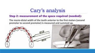 Cary’s analysis
Step 2: measurement of the space required (needed):
The mesio-distal width of the teeth anterior to the first molars (second
premolar to second premolar) is measured and summed up.
 