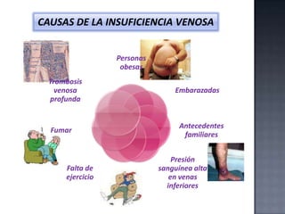 CAUSAS DE LA INSUFICIENCIA VENOSA
Personas
obesas
Trombosis
venosa
profunda

Fumar

Falta de
ejercicio

Embarazadas

Antecedentes
familiares
Presión
sanguínea alta
en venas
inferiores

 