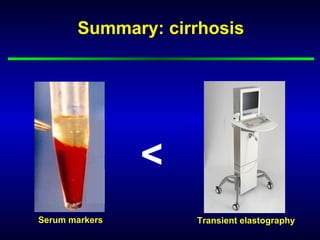 Summary: cirrhosis




                <
Serum markers       Transient elastography
 