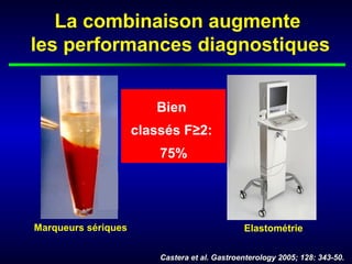 La combinaison augmente
les performances diagnostiques


                        Bien


                         +
                     classés F≥2:
                         75%




Marqueurs sériques                             Elastométrie

                         Castera et al. Gastroenterology 2005; 128: 343-50.
 