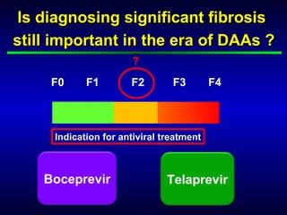 Is diagnosing significant fibrosis
still important in the era of DAAs ?
                       ?
     F0     F1        F2        F3        F4



     Indication for antiviral treatment



    Boceprevir                 Telaprevir
 