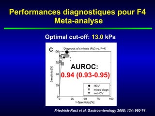 Performances diagnostiques pour F4
          Meta-analyse

        Optimal cut-off: 13.0 kPa




                  AUROC:
               0.94 (0.93-0.95)



           Friedrich-Rust et al. Gastroenterology 2008; 134: 960-74
 