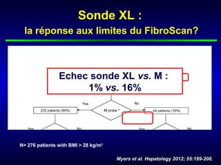 Sonde XL :
 la réponse aux limites du FibroScan?



                Echec sonde XL vs. M :
                     1% vs. 16%




N= 276 patients with BMI > 28 kg/m2

                                      Myers et al. Hepatology 2012; 55:199-208.
 