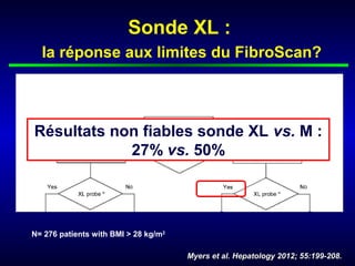 Sonde XL :
  la réponse aux limites du FibroScan?




Résultats non fiables sonde XL vs. M :
            27% vs. 50%




N= 276 patients with BMI > 28 kg/m2

                                      Myers et al. Hepatology 2012; 55:199-208.
 