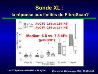 Sonde XL :
  la réponse aux limites du FibroScan?
                         AUC F2 0.83 vs 0.86 (NS)
                         AUC F4 0.94 vs 0.91 (NS)


                Median: 6.8 vs. 7.8 kPa
                            (p<0.0001)




N= 276 patients with BMI > 28 kg/m2   Myers et al. Hepatology 2012; 55:199-208.
 