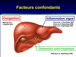 Facteurs confondants

Congestion                       Inflammation aigue
Millonig et al.                        Coco et al. J Viral Hepat 2007
J Hepatol 2010                         Arena et al. Hepatology 2008
                                       Sagir et al. Hepatology 2008




                           Cholestase extra-hepatique
                                    Millonig et al. Hepatology 2008
 