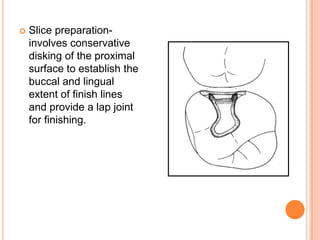    Slice preparation-
    involves conservative
    disking of the proximal
    surface to establish the
    buccal and lingual
    extent of finish lines
    and provide a lap joint
    for finishing.
 