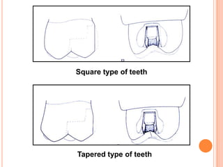 Square type of teeth




Tapered type of teeth
 