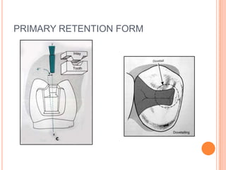 PRIMARY RETENTION FORM
 