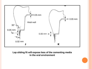 Lap sliding fit will expose less of the cementing media
                 in the oral environment
 