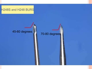 H248S and H248 BURS




      45-60 degrees
                      70-80 degrees
 
