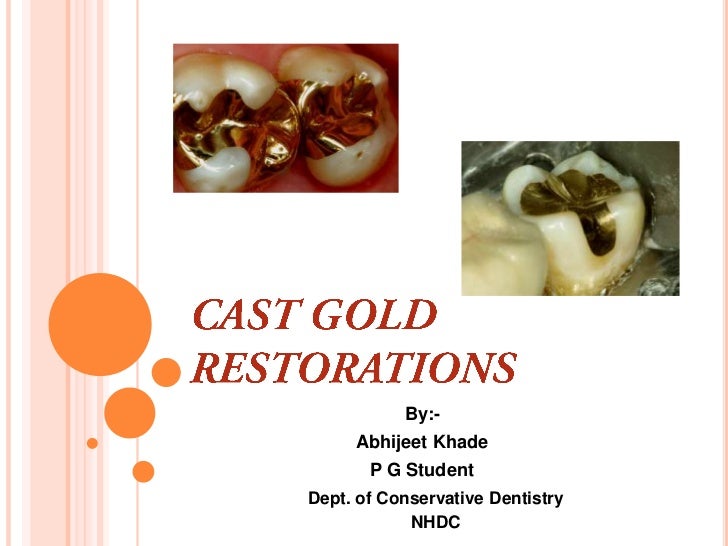 Cast gold Inlay restorations
