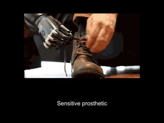 Sensitive prosthetic
 