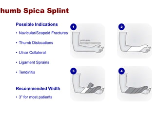 casting-splinting.ppt
