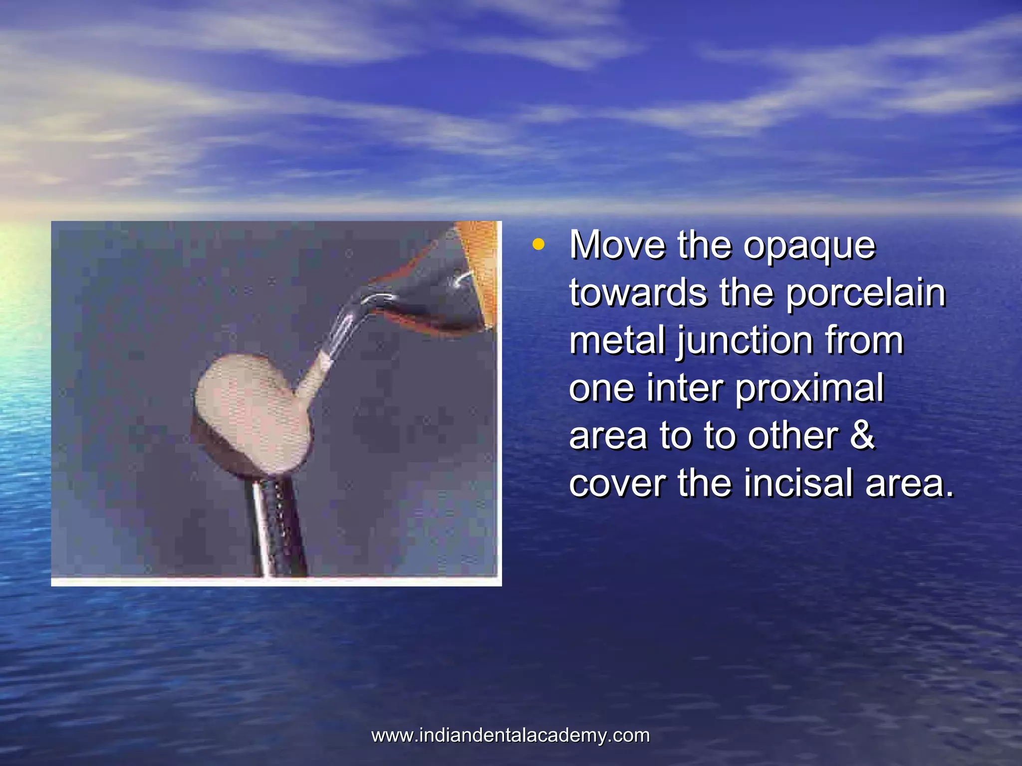 • Move the opaqueMove the opaque
towards the porcelaintowards the porcelain
metal junction frommetal junction from
one inter proximalone inter proximal
area to to other &area to to other &
cover the incisal area.cover the incisal area.
www.indiandentalacademy.comwww.indiandentalacademy.com
 