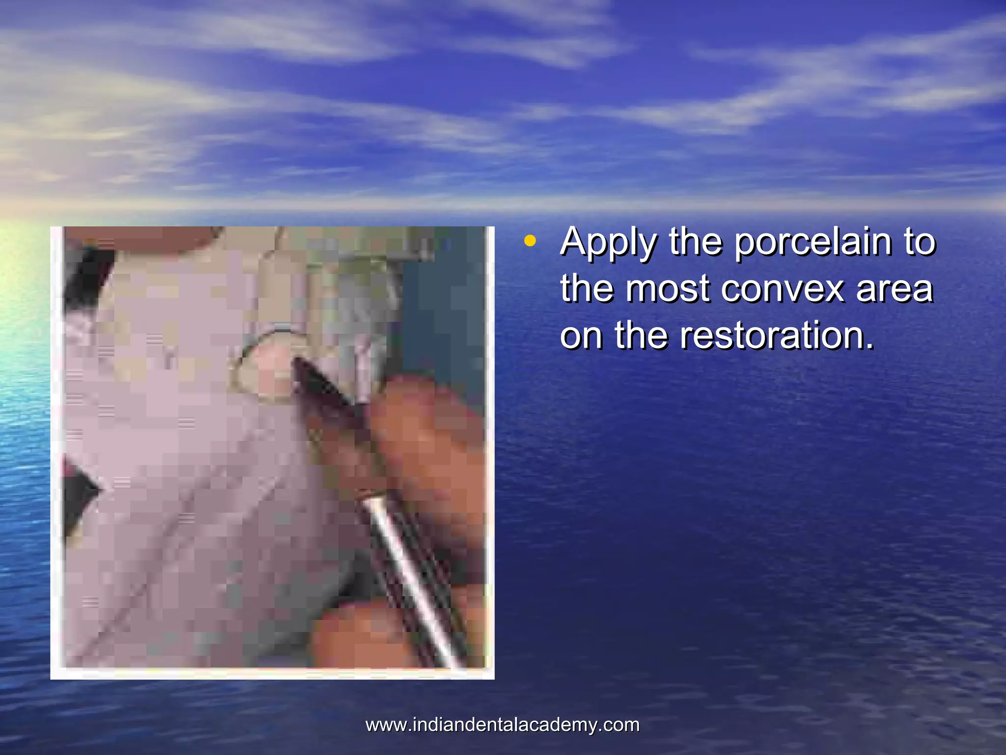 • Apply the porcelain toApply the porcelain to
the most convex areathe most convex area
on the restoration.on the restoration.
www.indiandentalacademy.comwww.indiandentalacademy.com
 