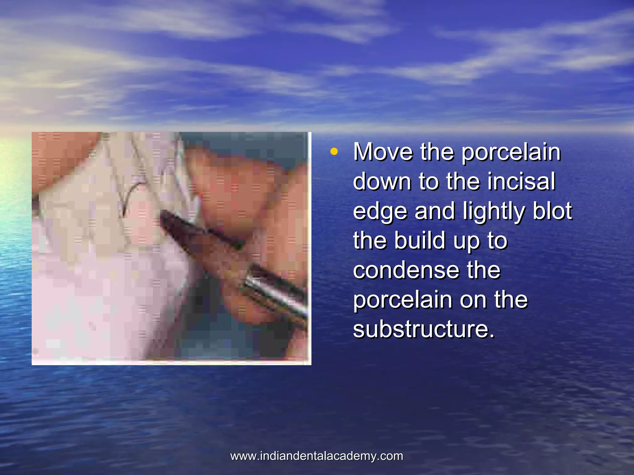• Move the porcelainMove the porcelain
down to the incisaldown to the incisal
edge and lightly blotedge and lightly blot
the build up tothe build up to
condense thecondense the
porcelain on theporcelain on the
substructure.substructure.
www.indiandentalacademy.comwww.indiandentalacademy.com
 
