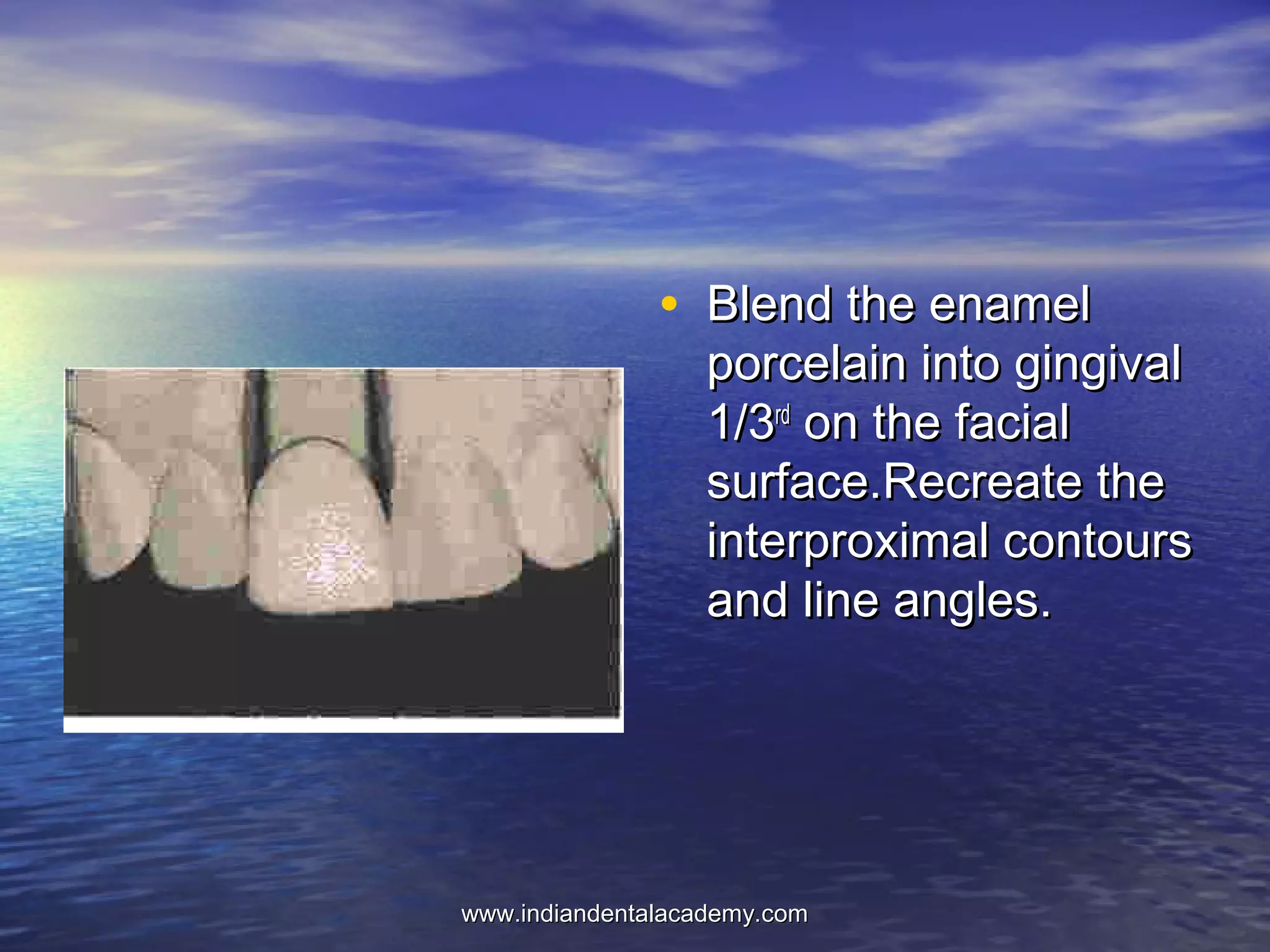 • Blend the enamelBlend the enamel
porcelain into gingivalporcelain into gingival
1/31/3rdrd
on the facialon the facial
surface.Recreate thesurface.Recreate the
interproximal contoursinterproximal contours
and line angles.and line angles.
www.indiandentalacademy.comwww.indiandentalacademy.com
 