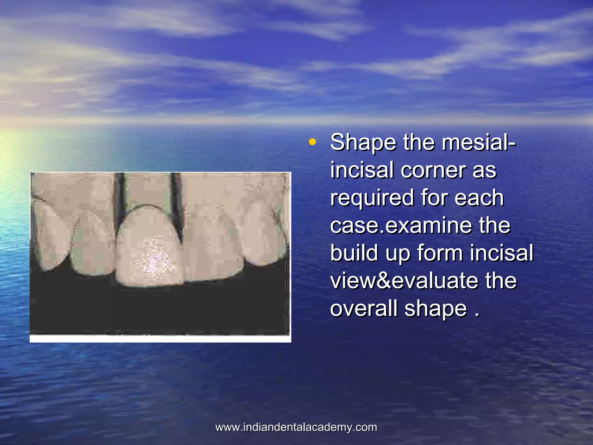 • Shape the mesial-Shape the mesial-
incisal corner asincisal corner as
required for eachrequired for each
case.examine thecase.examine the
build up form incisalbuild up form incisal
view&evaluate theview&evaluate the
overall shape .overall shape .
www.indiandentalacademy.comwww.indiandentalacademy.com
 