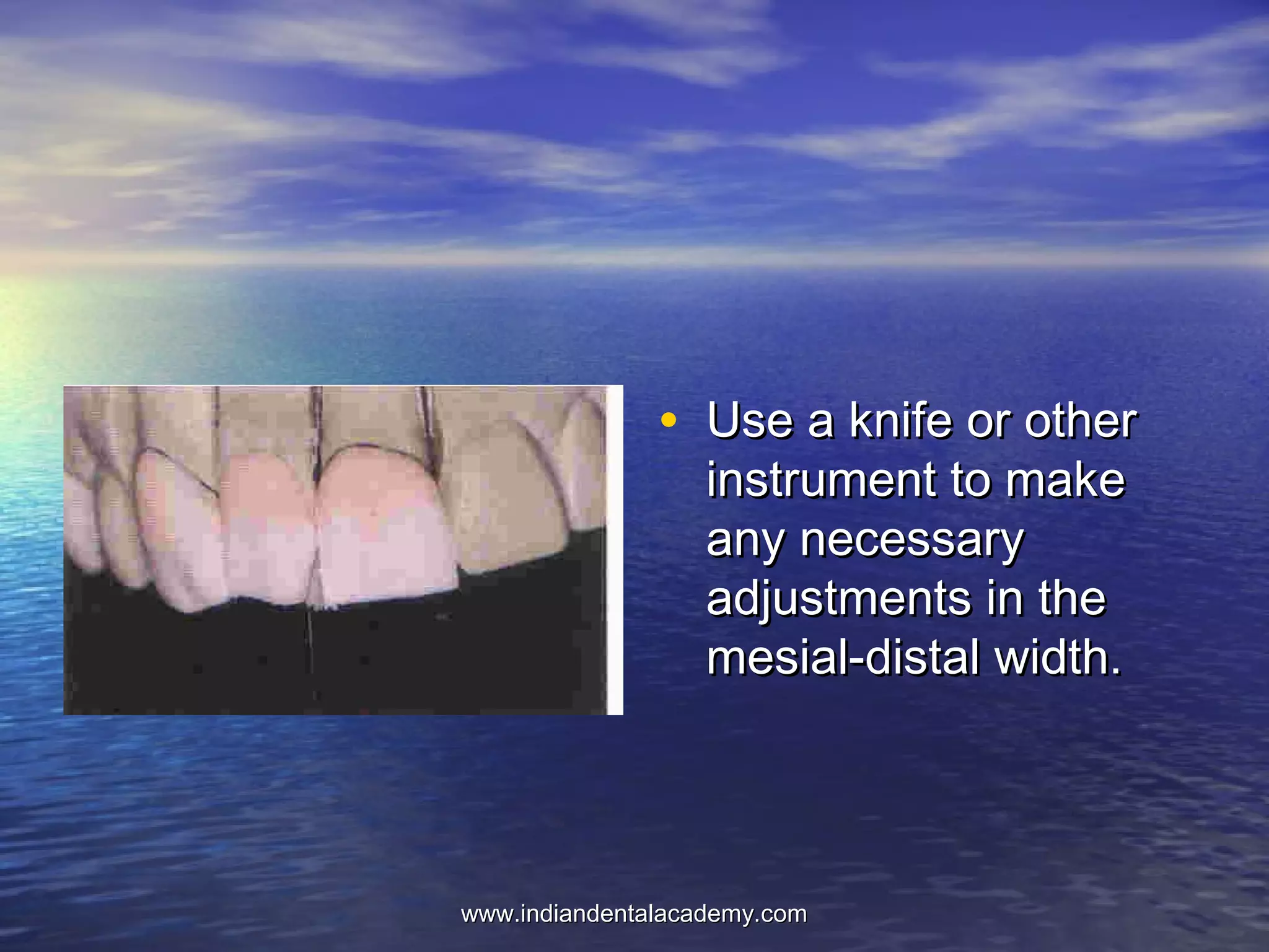 • Use a knife or otherUse a knife or other
instrument to makeinstrument to make
any necessaryany necessary
adjustments in theadjustments in the
mesial-distal width.mesial-distal width.
www.indiandentalacademy.comwww.indiandentalacademy.com
 