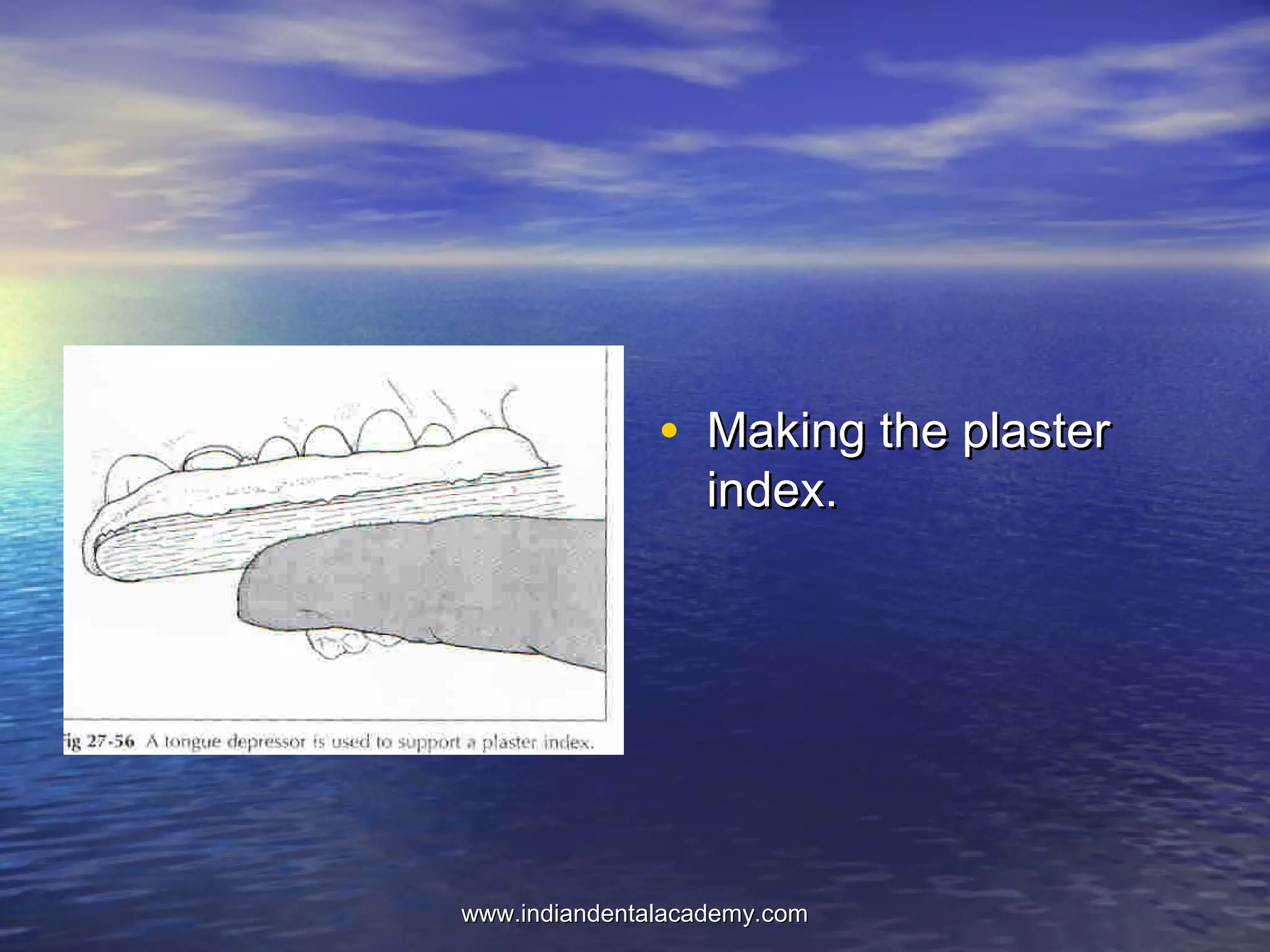• Making the plasterMaking the plaster
index.index.
www.indiandentalacademy.comwww.indiandentalacademy.com
 