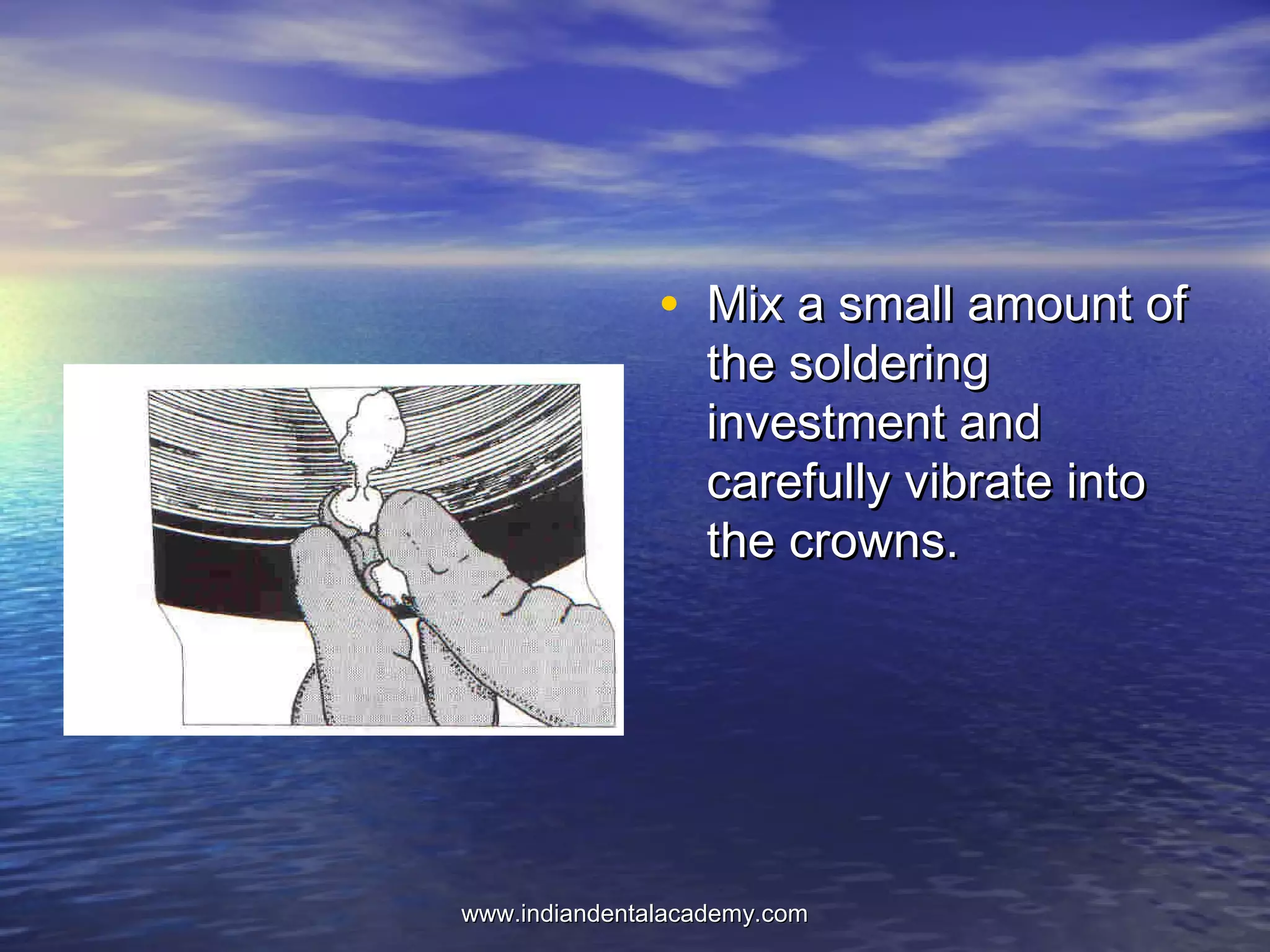 • Mix a small amount ofMix a small amount of
the solderingthe soldering
investment andinvestment and
carefully vibrate intocarefully vibrate into
the crowns.the crowns.
www.indiandentalacademy.comwww.indiandentalacademy.com
 