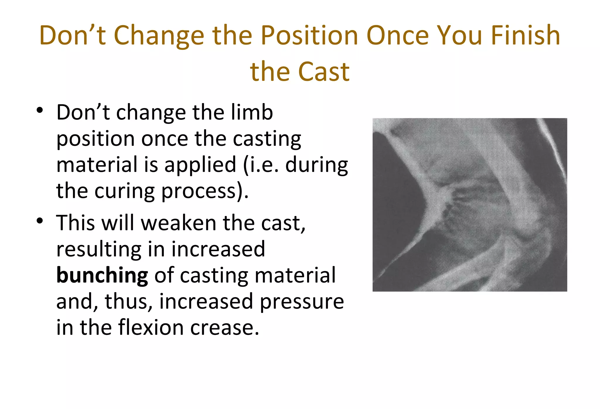Don’t Change the Position Once You Finish
the Cast
• Don’t change the limb
position once the casting
material is applied (i.e. during
the curing process).
• This will weaken the cast,
resulting in increased
bunching of casting material
and, thus, increased pressure
in the flexion crease.
 