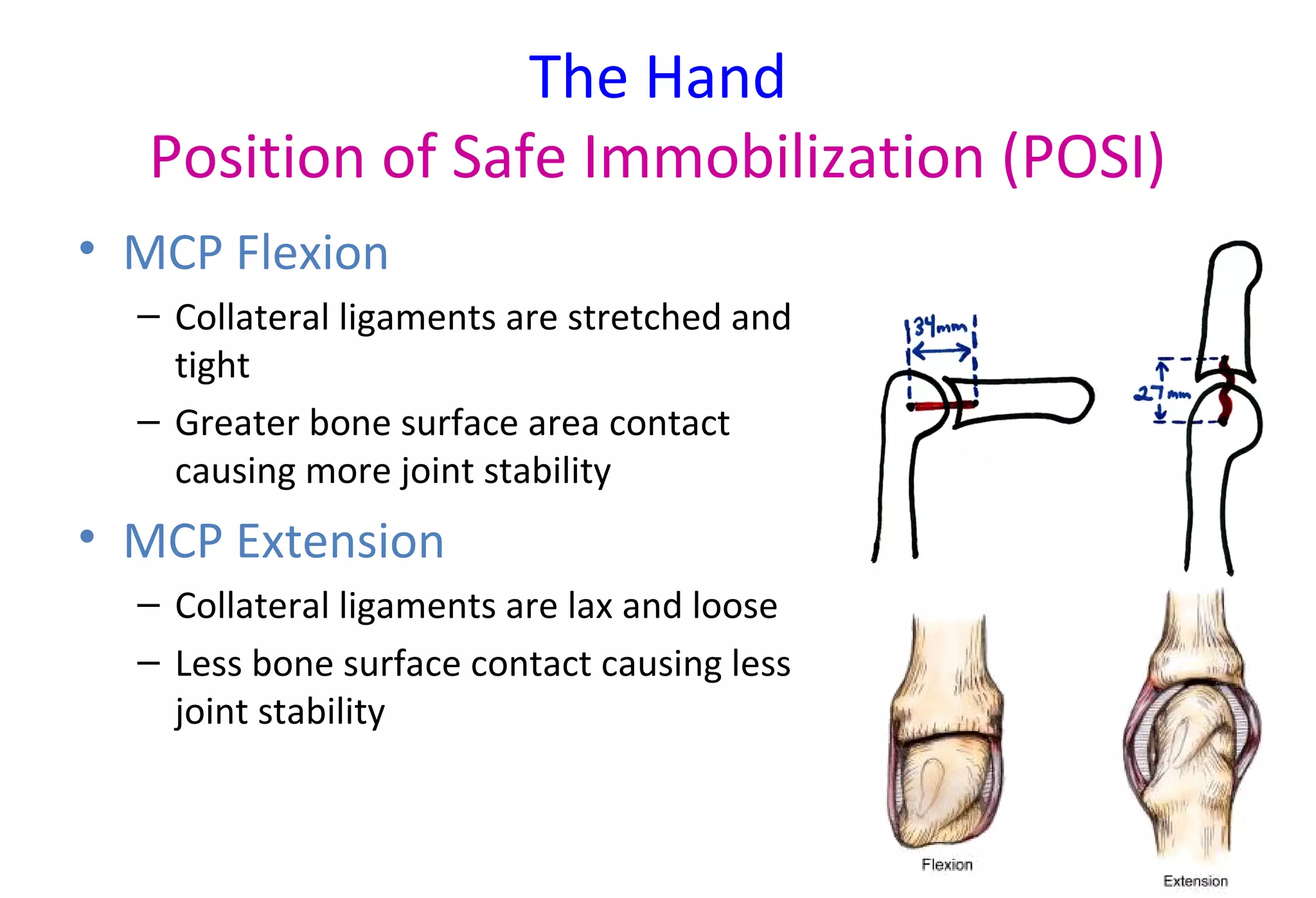 The Hand
Position of Safe Immobilization (POSI)
• MCP Flexion
– Collateral ligaments are stretched and
tight
– Greater bone surface area contact
causing more joint stability
• MCP Extension
– Collateral ligaments are lax and loose
– Less bone surface contact causing less
joint stability
 