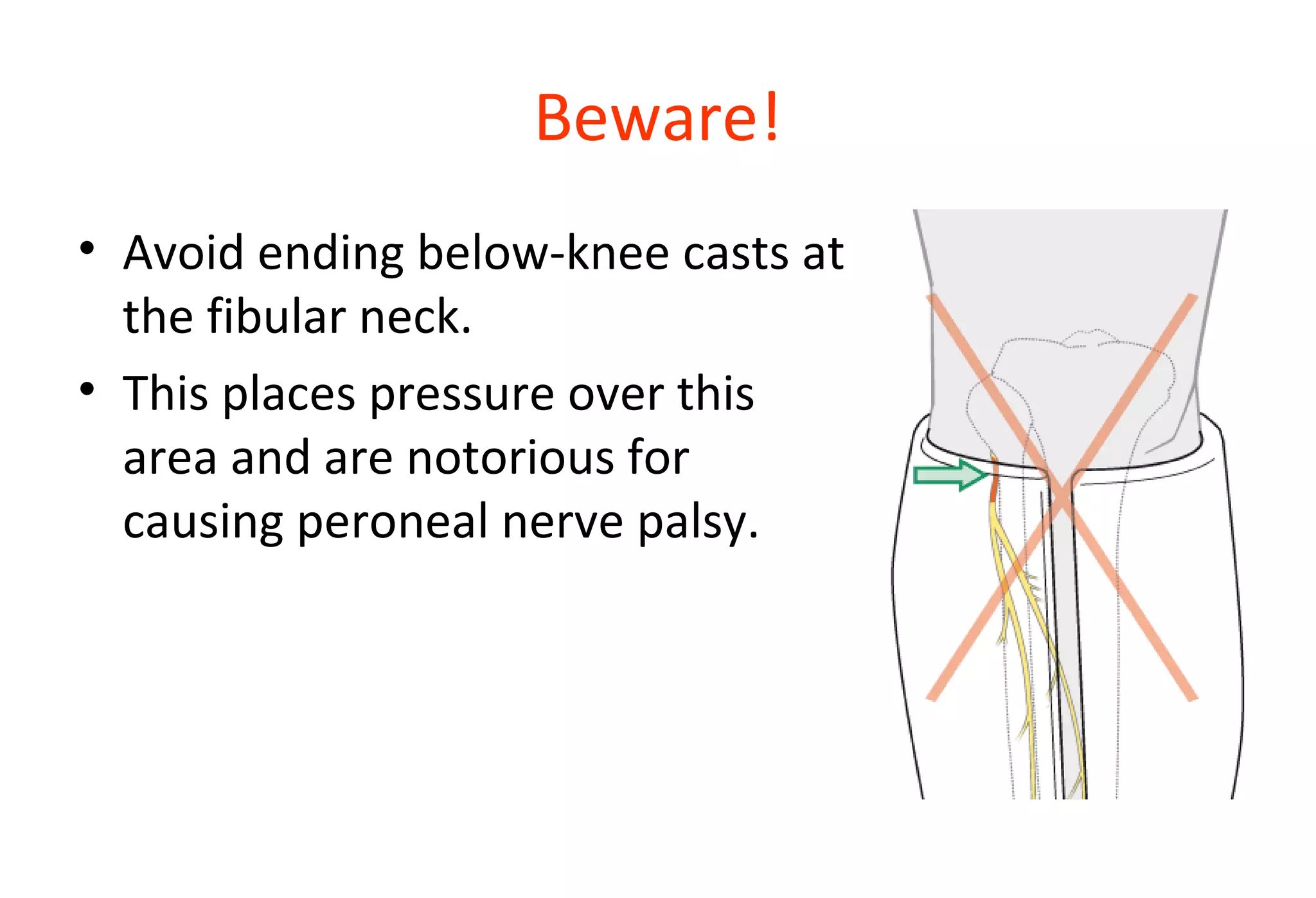 Beware!
• Avoid ending below-knee casts at
the fibular neck.
• This places pressure over this
area and are notorious for
causing peroneal nerve palsy.
 