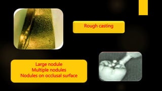 Rough casting
Large nodule
Multiple nodules
Nodules on occlusal surface
 