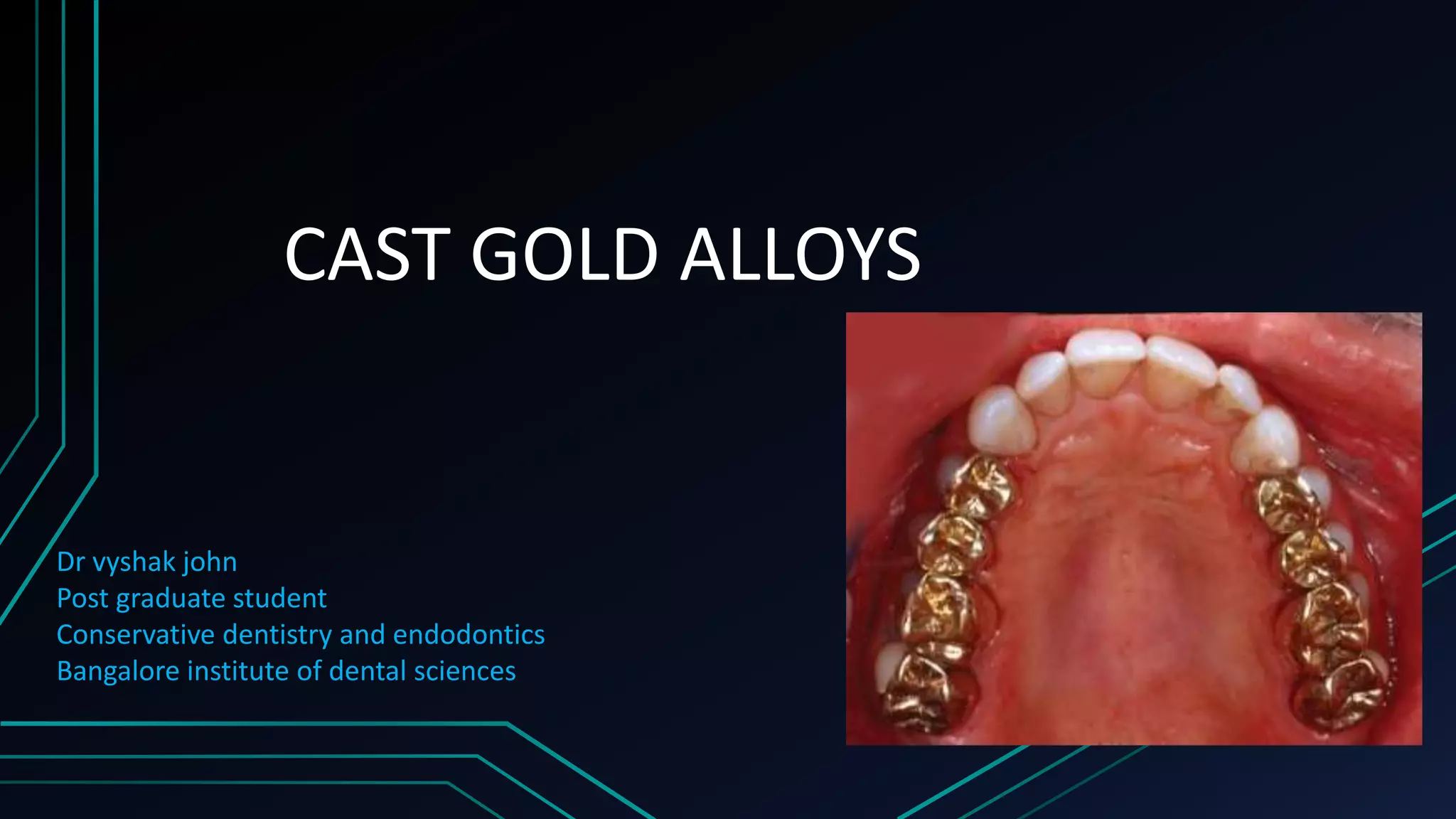 Compression Casting Gold Casting gold alloys | PPTX