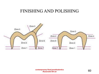 FINISHING AND POLISHING
60
contemprorary fixed prosthodontics
Rosenstiel 5th ed
 
