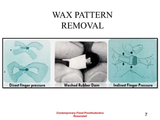 7
WAX PATTERN
REMOVAL
Contemprorary Fixed Prosthodontics
Rosensteil
 