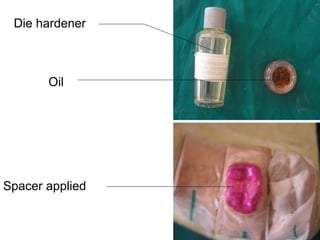 Die hardener
Oil
Spacer applied
 