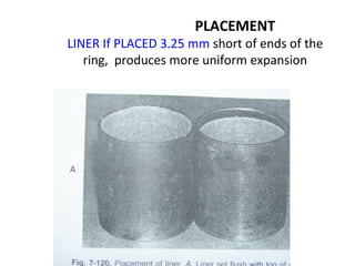 PLACEMENT
LINER If PLACED 3.25 mm short of ends of the
ring, produces more uniform expansion
 