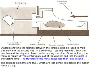 Diagram showing the relation between the ceramic crucible used to melt
the alloy and the casting ring in a centrifugal casting machine . Both the
crucible and the ring are placed on the casting machine . Once molten , the
metal is rapidly driven centrifugally out of the crucible and into the mold in
the casting ring . The traverse of the metal takes less than one second .
The oxidized elements and flux , which are less dense ,lag behind the molten
metal as lag.
 