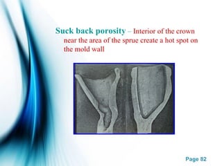 Page 82
Suck back porosity – Interior of the crown
near the area of the sprue create a hot spot on
the mold wall
 