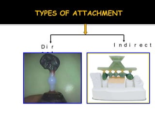 TYPES OF ATTACHMENT
D i r
e c t
I n d i r e c t
 