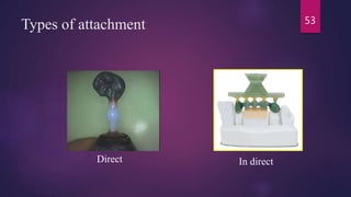 Types of attachment
Direct In direct
53
 