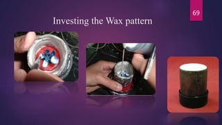 Investing the Wax pattern
69
 